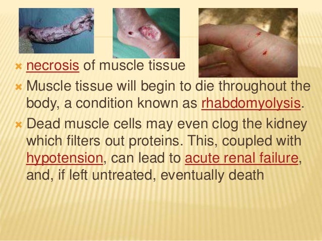dialysis technician flashcards