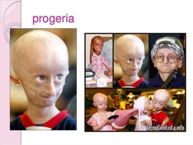 A luz pigmentary nota abaixo de um olho