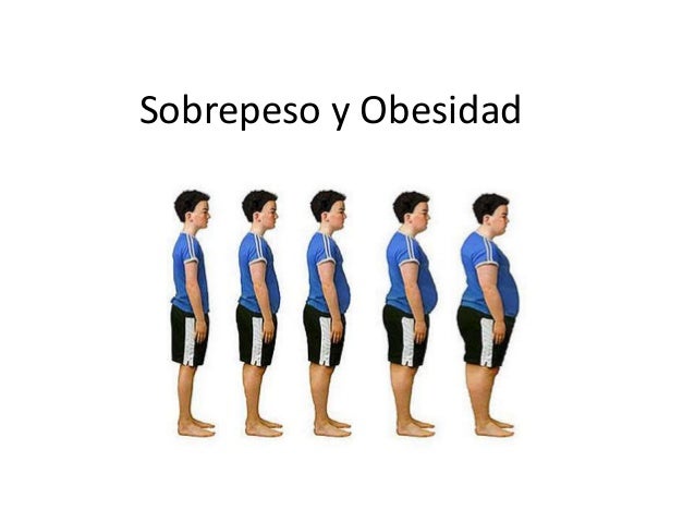 Sobrepeso y Obesidad
 