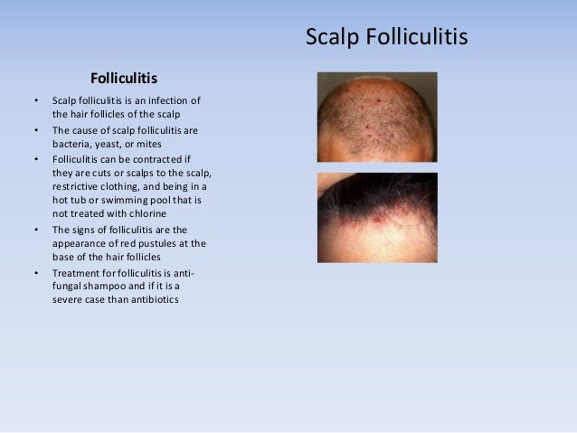 What are mon Causes of A Sore Scalp what are mon causes of a sore scalp
