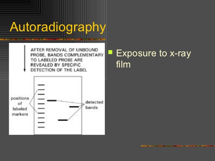 Southern northern and western blotting