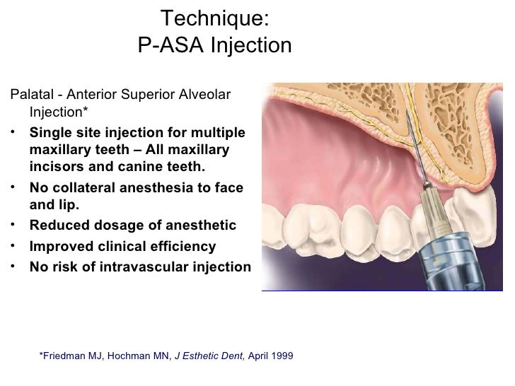 Speaker Sta Slides, Script Erc Compressed