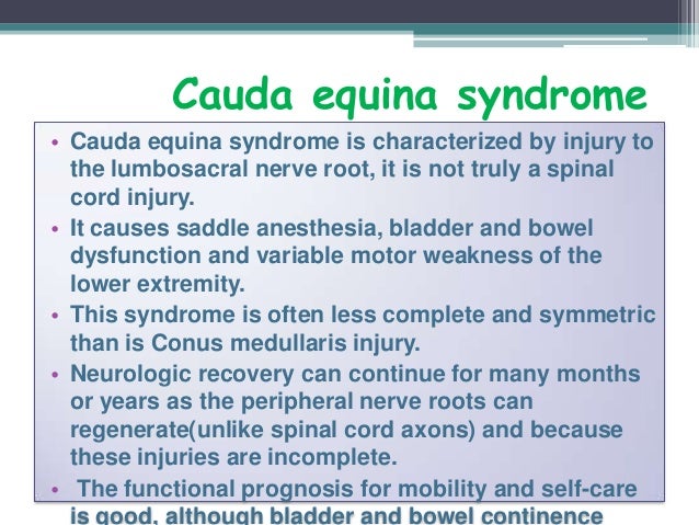 Cauda Equina Syndrome Outlook For Recovery