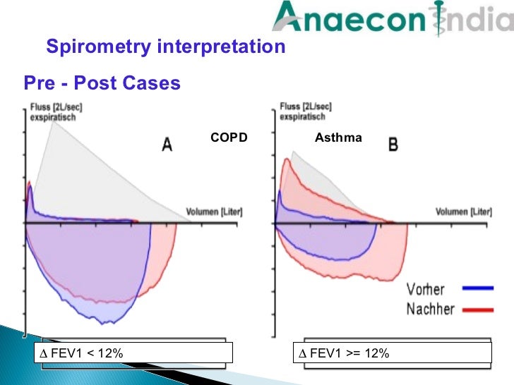 Anaecon India Spirometery