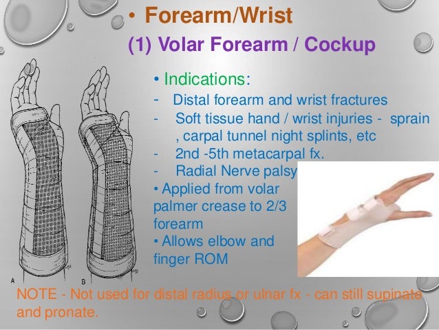 Pics Volar Splint Pics Volar Splint