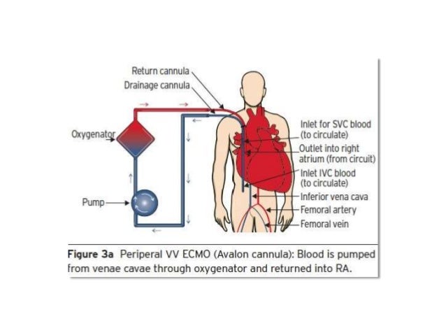 What is ecmo used for in adults