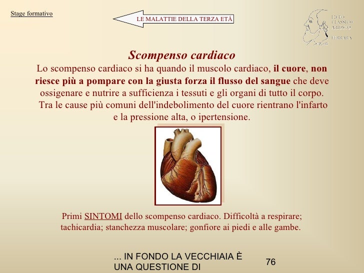 Il miglior unguento di emorroidi Ucraina
