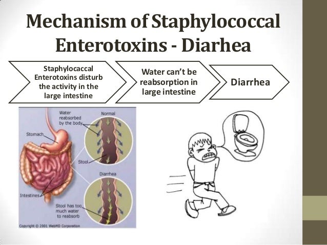 Staphylococcal food poisoning