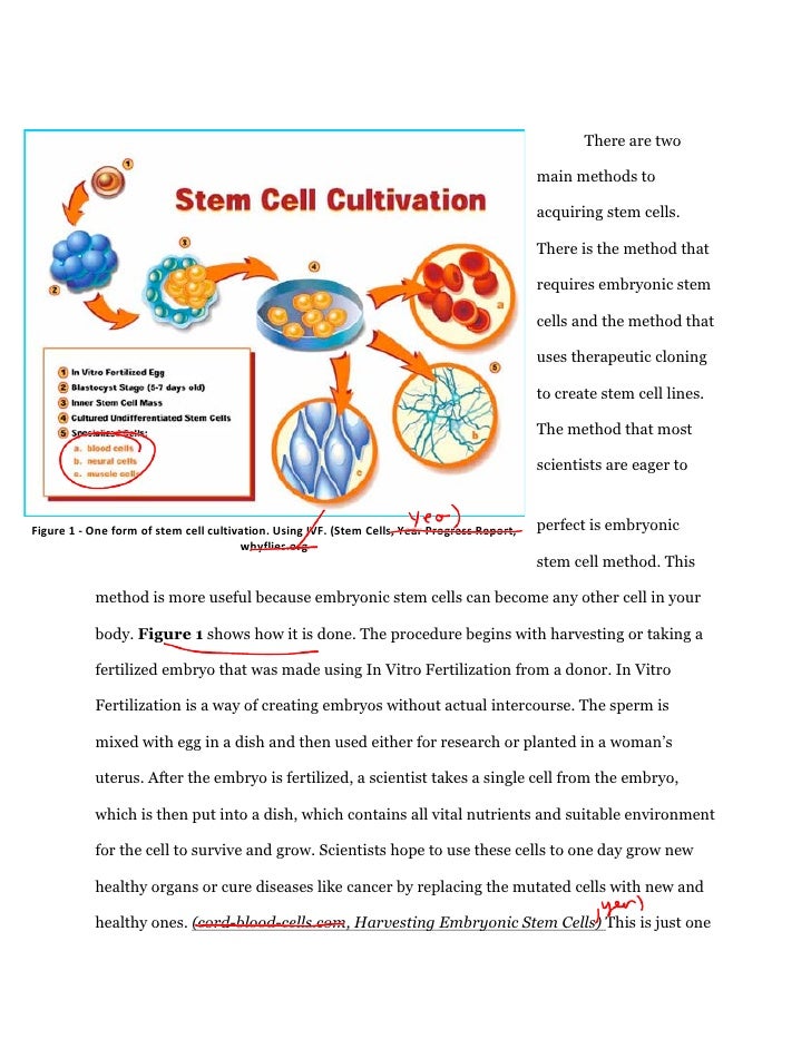 Stem cell research argument essay - Custom writing experts
