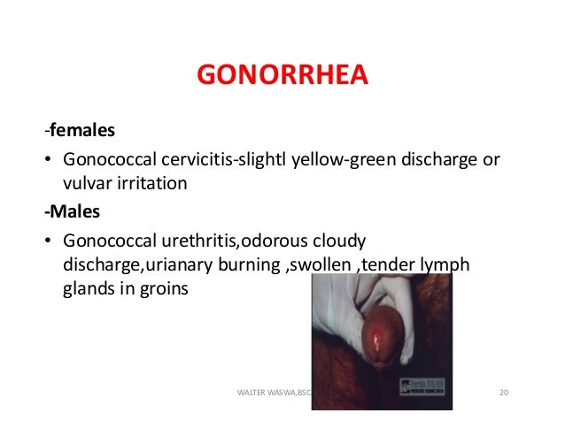 STD&HIV AIDS FOR KRCHN NORTH COAST MEDICAL TRAINING COLLEGE LECTURES