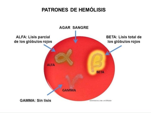 Streptococcus Pyogenes