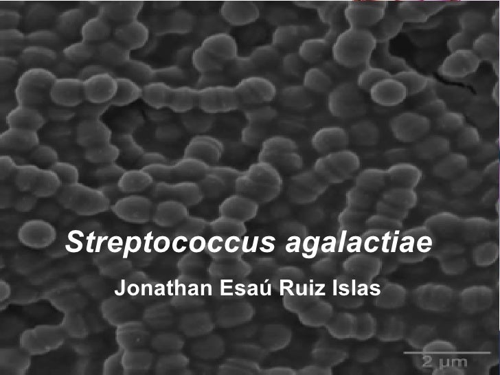 Streptococcus agalactiae у мужчин как лечить Streptococcus agalactiae у мужчин как лечить
