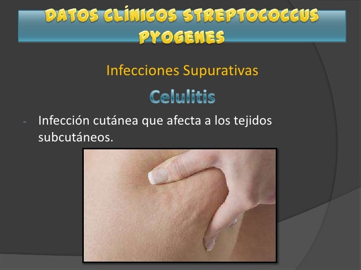 La psoriasis de los genitales a los hombres