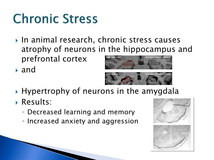 The Effects Of Stress On Learning And