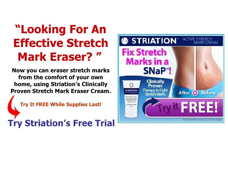 eraser cream for stretch marks