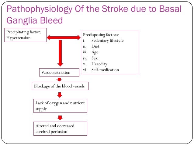 stroke remedy coumadin