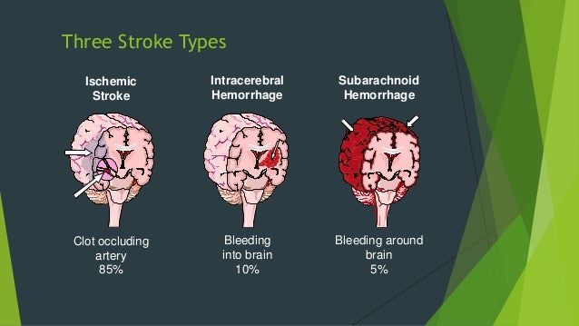 Moderate stroke domestic remedies reversing stroke consequences