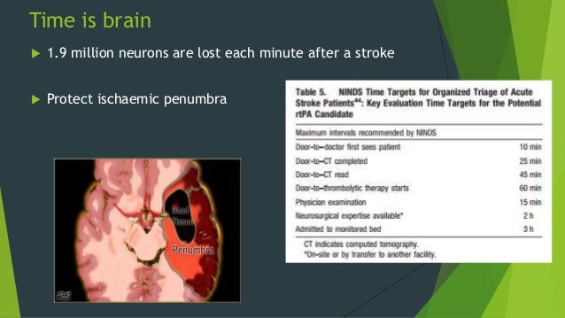 Mini stroke from stress stroke care audit
