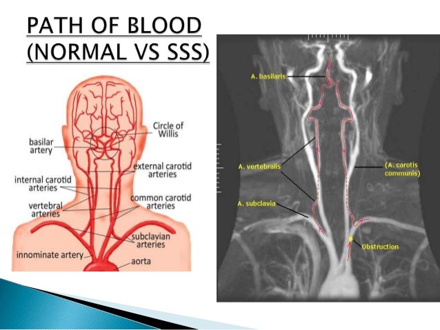 Cervical remedy in hindi cervical gout