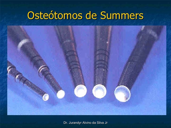 Summers Alunos
