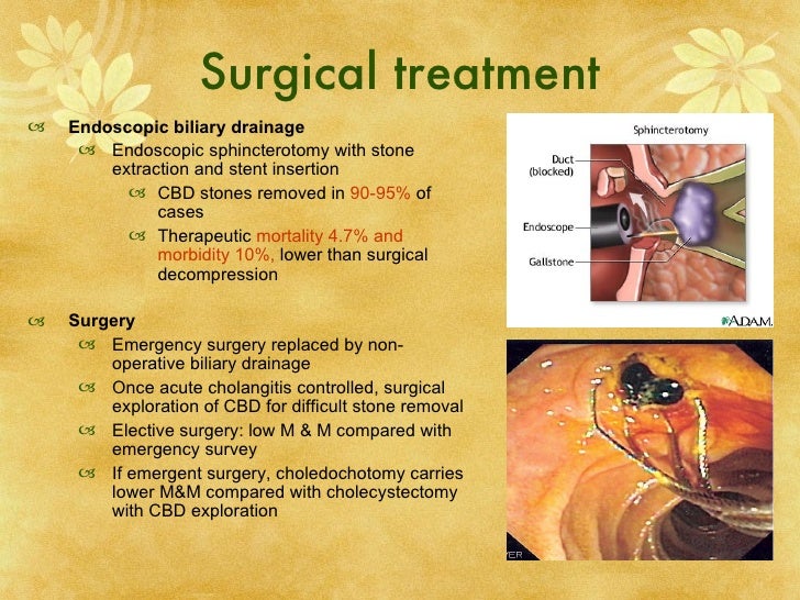 Surgery cholangitis[1]