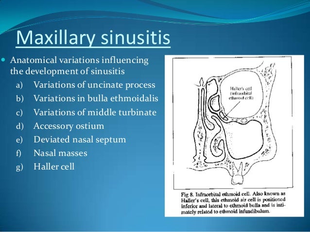 Ethmoid sinusitis eye socket contamination headache sinus returned of head