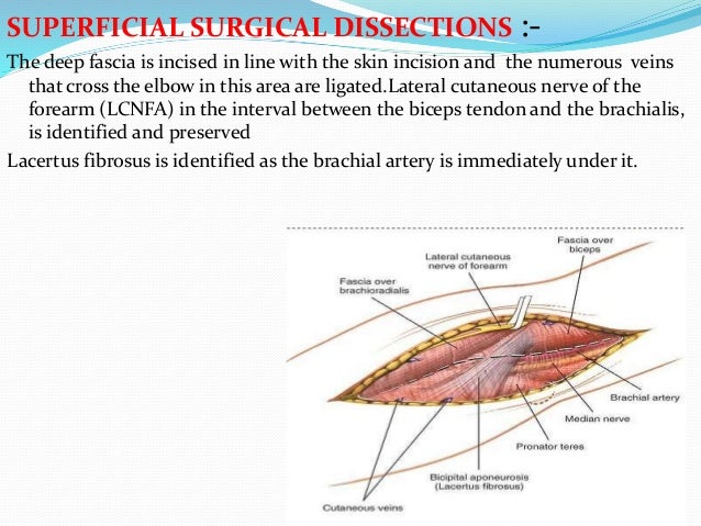 Surgical approaches to the elbow