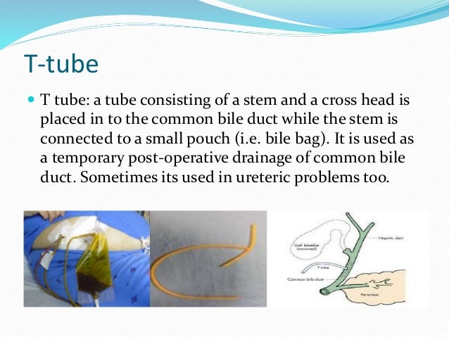 surgical drains t tube drain