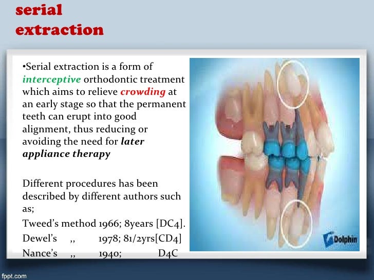 Surgical orthodonticsminor surgical procedures