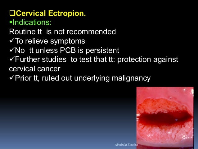 what is cervical backbone most cancers