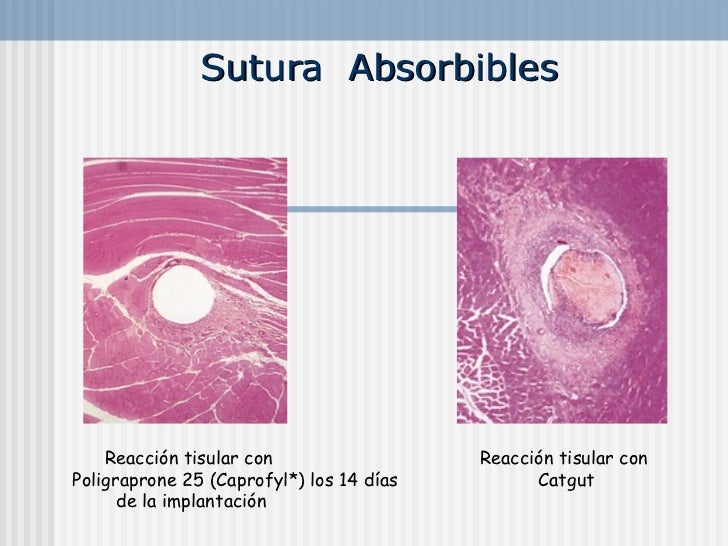 Sutura