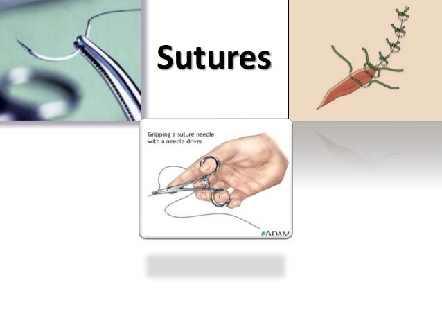 Sutures