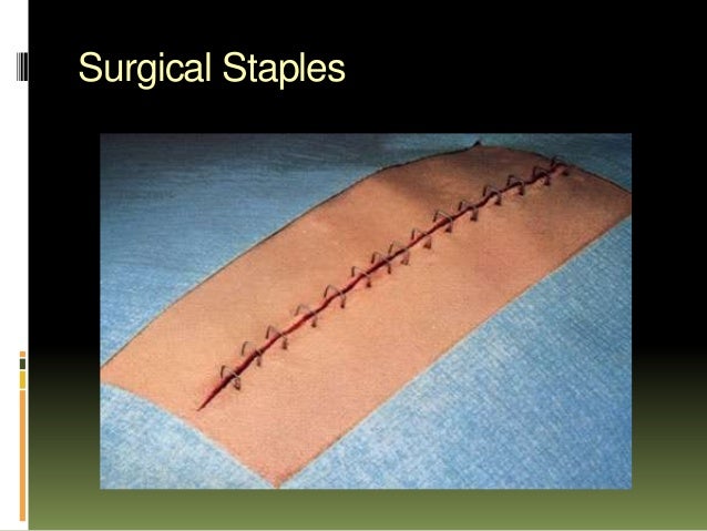 Sutures and mesh wound healing diagram 