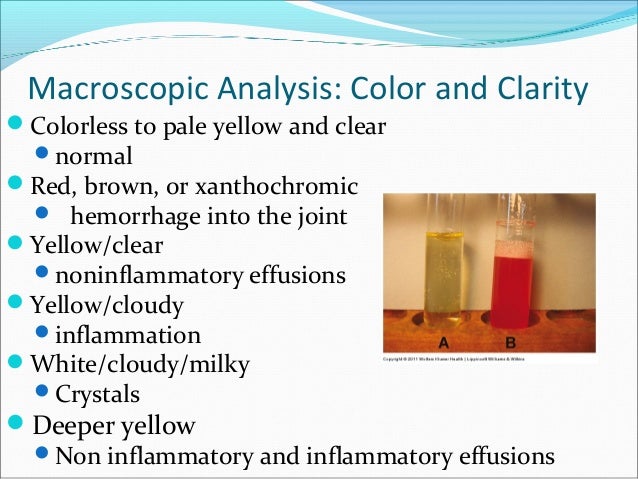synovial fluid viscosity test