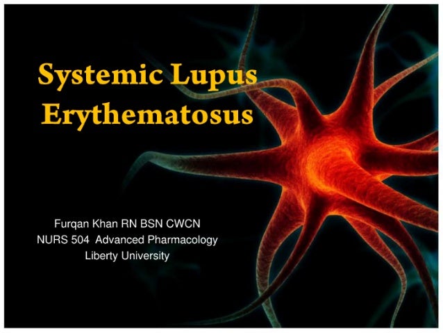sle jeopardy powerpoint sle templates for ppt systemic lupus erythematosus sle jeopardy powerpoint sle templates for ppt systemic lupus erythematosus