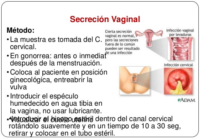 Introducir Especulo Vagina 16