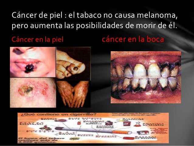 Hasta que mes del embarazo es posible dejar fumar
