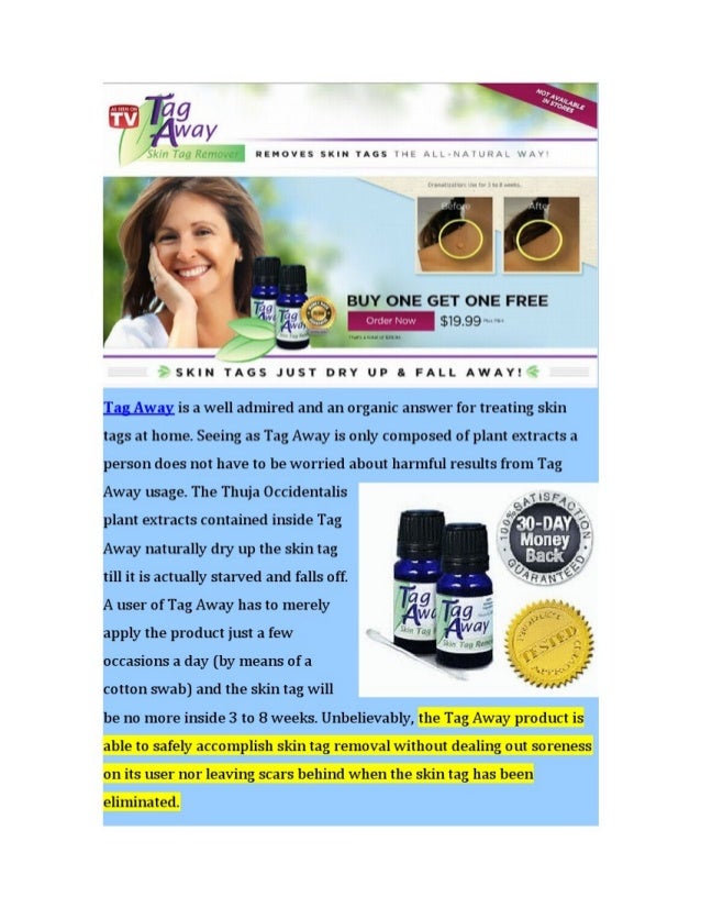 All Natural Way To Remove Skin Tags All Natural Way To Remove Skin Tags
