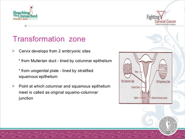 What does cervical cancer look like on an ultrasound ovarian uterine cervical most cancers signs