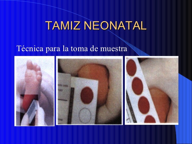 Tamiz Neonatal Y Eim