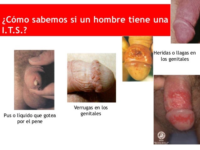 Goluba la arcilla la máscara sobre la persona