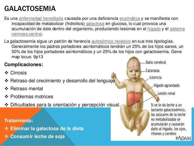 Tamiz metabólico neonatal Tamiz metabólico neonatal
