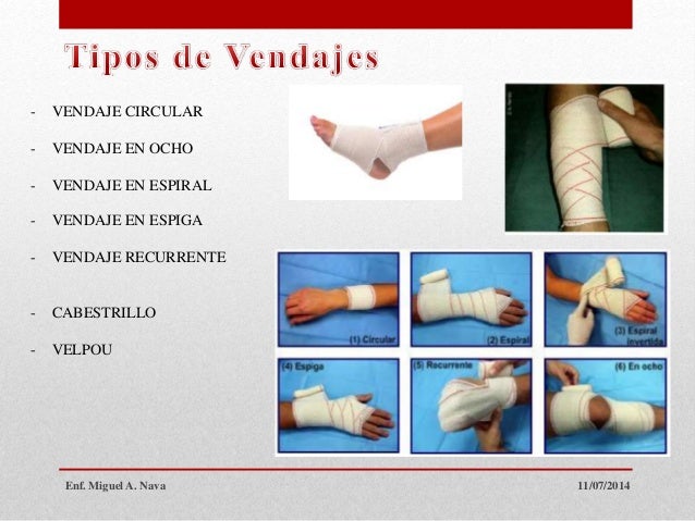 Técnicas de vendaje