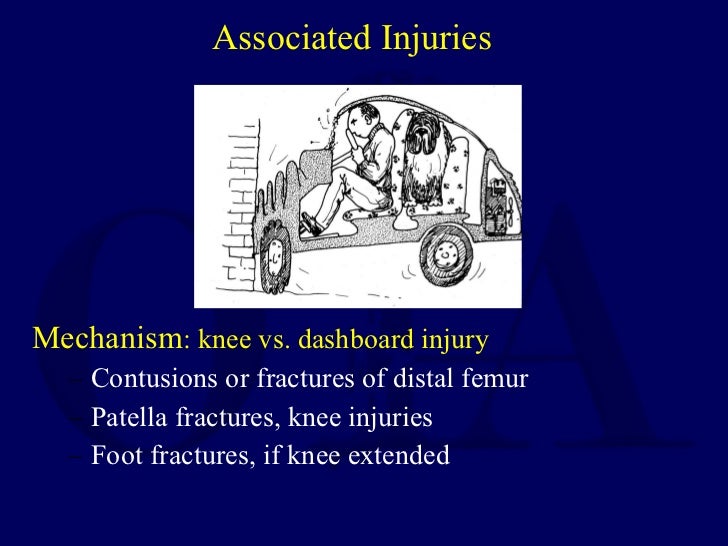 Management of Hip Dislocations
