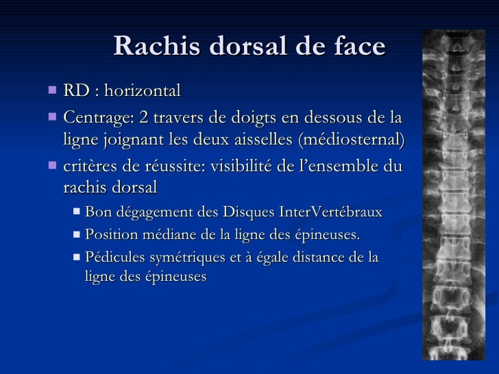 Que traiter les hernies intervertébrales et protrouzii