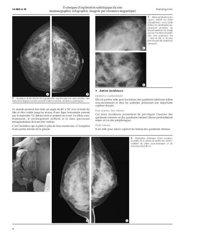 cancer du poumon wikipedia