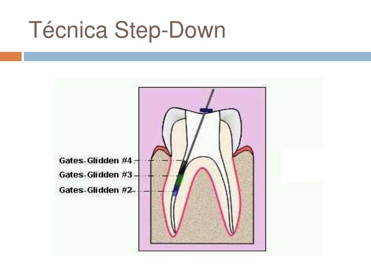 Tecnicas apico y corono apicales