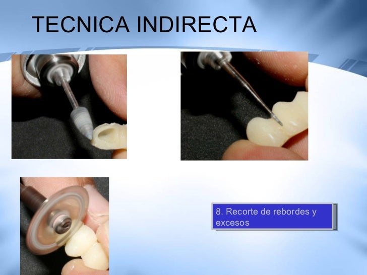 Tecnicas De Temporalizacion Y Restauraciones Provisionales