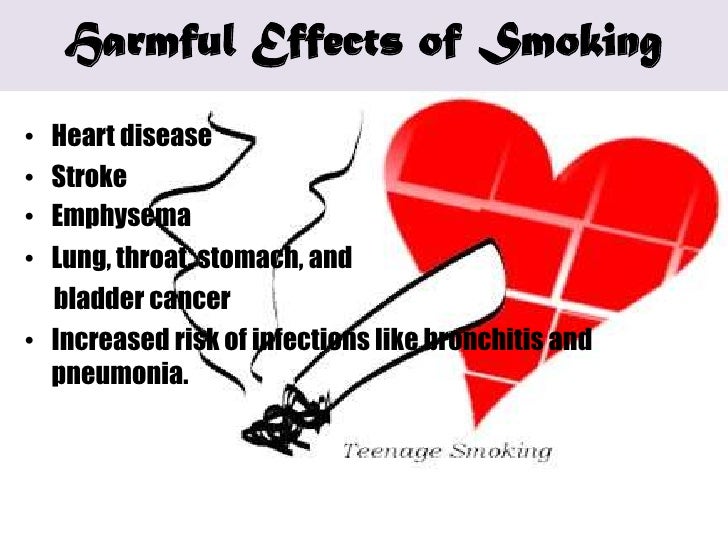 Hiv Essay Paper Essay About Smoking Effect Essay Video Games Cause Bad Behaviour A Modest Proposal Essay Topics also Proposal Essay Topics Examples Essay About Smoking Effect Up In Smoke The Recondite Perils Of How To Write Proposal Essay