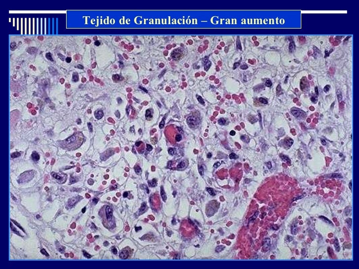 Histología - Tejido conectivo - Dr. Requena